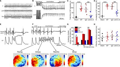 Interleukin-6-Mediated-Ca2+ Handling Abnormalities Contributes to Atrial Fibrillation in Sterile Pericarditis Rats